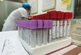 空腹抽血能喝水吗？检验人最常被问的 5 个问题