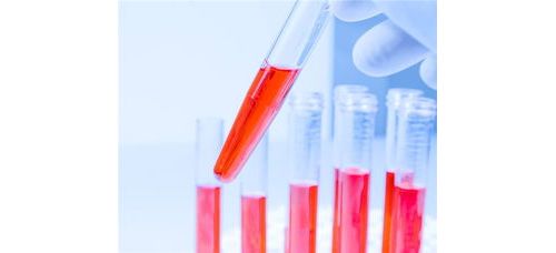 分享 | 常用检验医学知识大汇总！