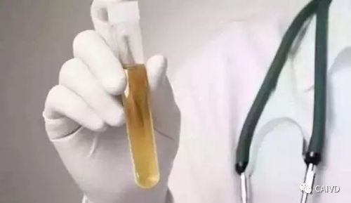 医学检验人必懂的基本概念，赶紧收藏备用！