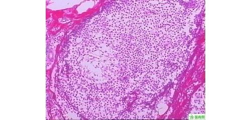 重视规范化病理检测实现标准化实验室管理