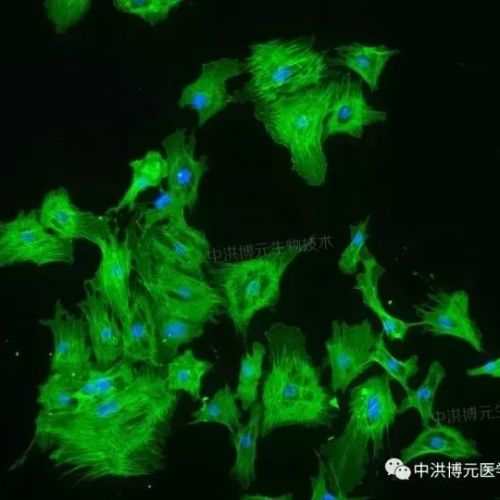 实验专栏丨免疫荧光双标实验，哪一步最容易出错？