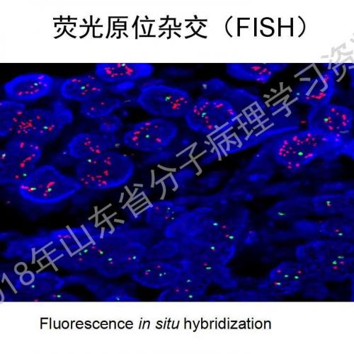 FISH原理及操作判读