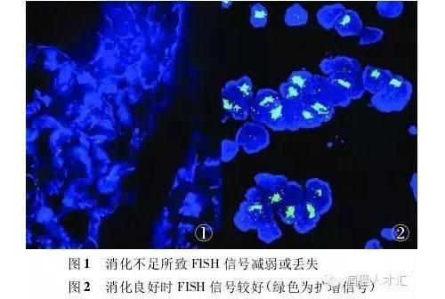 荧光原位杂交技术操作的注意事项及常见问题