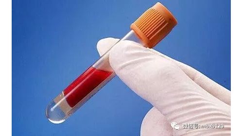 查融合基因是抽血还是做骨髓穿刺?