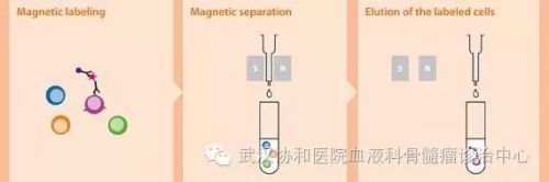 免疫磁珠分选 + 荧光原位杂交技术：促进多发性骨髓瘤精准化诊疗 ... ...