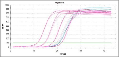 荧光定量 PCR 技术在产前诊断中的应用专家共识