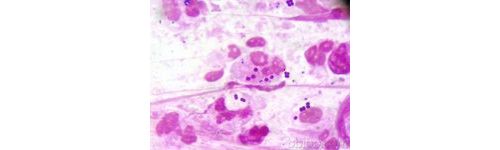 卡他莫拉菌快速鉴定的方法学及耐药性研究（上）