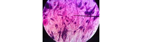 卡他莫拉菌快速鉴定的方法学及耐药性研究（中）