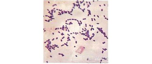 卡他莫拉菌快速鉴定的方法学及耐药性研究（下）