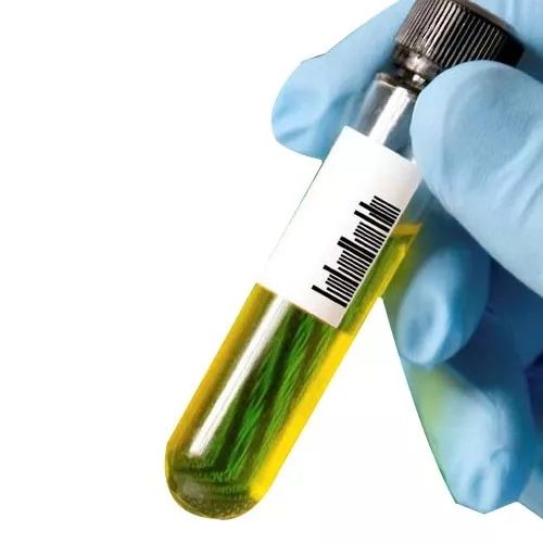 ANCA间接免疫荧光法检测真的不需要了吗？