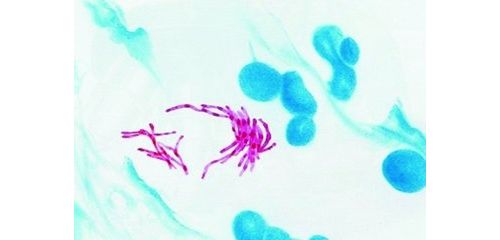 临床微生物实验室分枝杆菌操作指南中有关核酸扩增技术的建议 ...