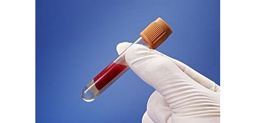 手术感染八项的检测方法及临床意义（下）