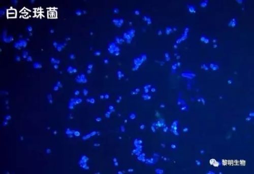 肺部真菌感染病原学检测的方法及临床意义