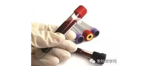15项孕检项目全面解析