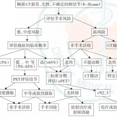 肺结节诊治中国专家共识（2018年版）（中）
