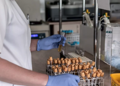 府伟灵教授谈检验医学的发展与实验室的智能化