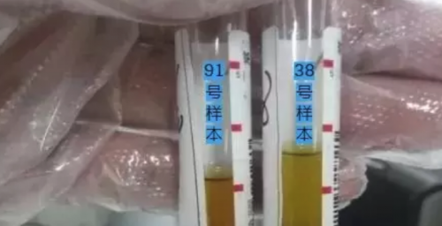 非肿瘤性NSE的升高——隐性溶血