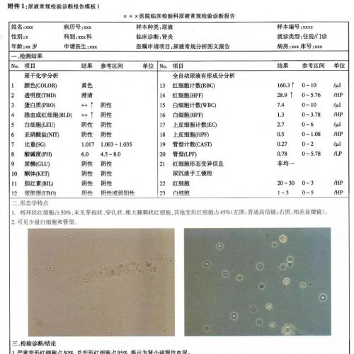 【专家共识】尿液常规检验诊断报告模式专家共识发布
