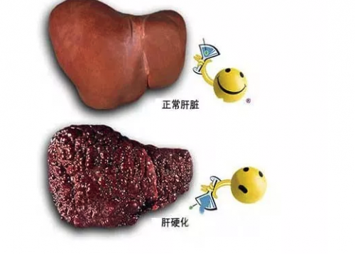 乙肝表面抗原（HBsAg）阳性能转阴吗？