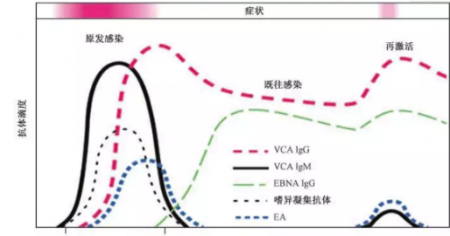 EB病毒感染实验室诊断及临床应用专家共识解读（上）