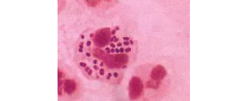 《沙眼衣原体和/或淋病奈瑟菌核酸检测试剂注册技术审查指导原则（征求意见稿）》 ...  ...