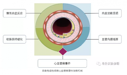 自身抗体检测：心血管疾病中寻找致病“真凶”