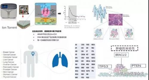 应用二代测序技术检测乳腺癌易感基因BRCA1/2、TP53和PTEN胚系突变 ...
