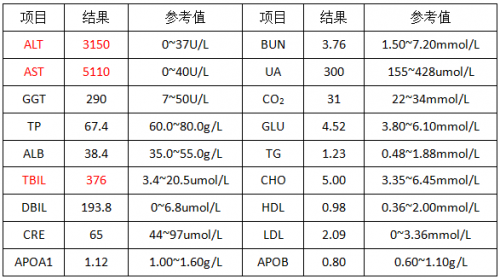 【检验临床面对面】AST结果一天内怎么会相差1300U/L？