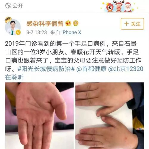 手足口病又来了，连家长都被传染上！（下）