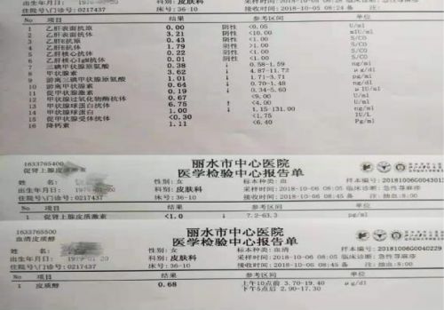 如何读懂甲功的“七十二变”