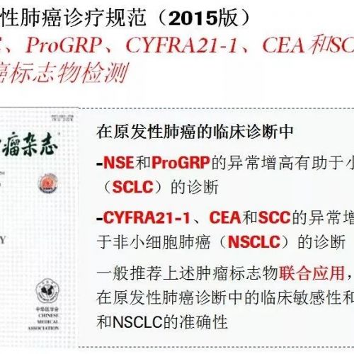 NSE、ProGRP、CYFRA21-1、CEA和SCC肺癌检测五大重要指标意义及价值！ ...