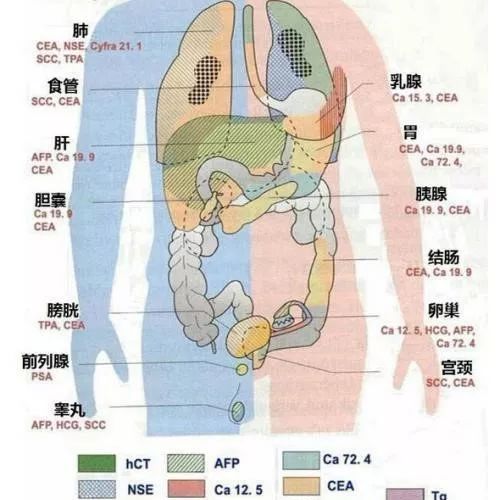 癌胚抗原（CEA）异常与烟酒有关系吗？