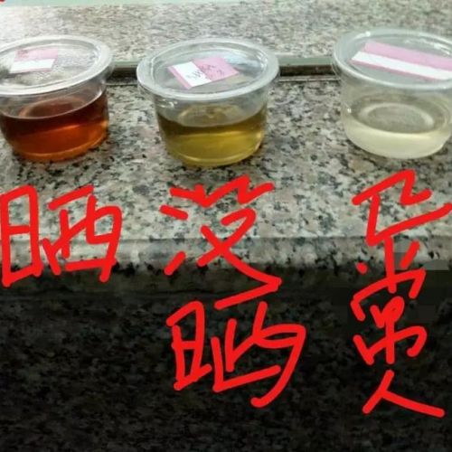 杭州护士患“吸血鬼症”，晒『尿』就可以诊断