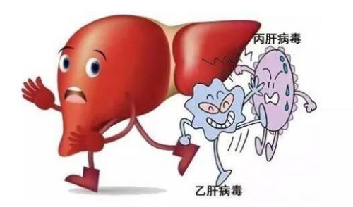 重大医疗事故的警示：术前为什么要查乙肝、丙肝、梅毒、艾滋？ ...
