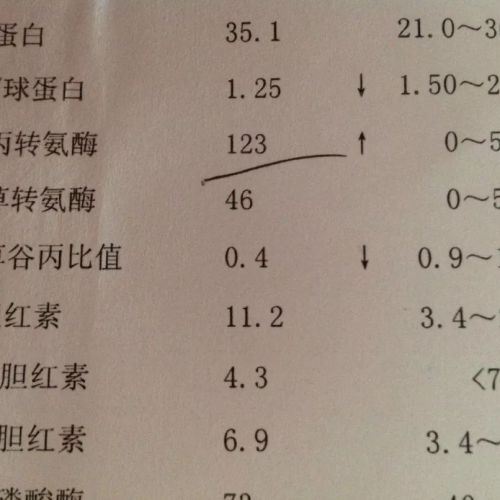 谷丙转氨酶和谷草转氨酶有什么区别？