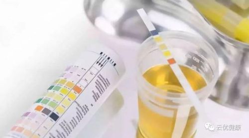 尿白蛋白检测实验室应注意的问题