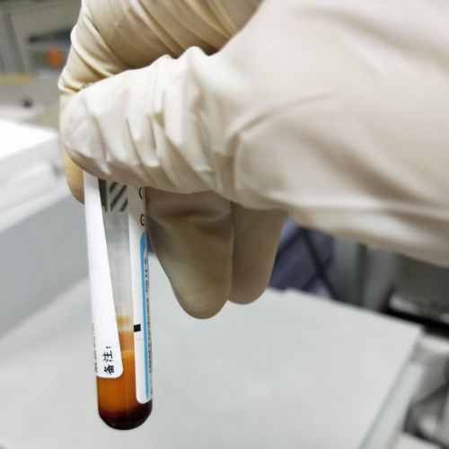细节决定成败，谈谈容易被忽视的凝血时间手工法