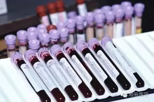 感染患者WBC、CRP、PCT结果不一致时如何分析？