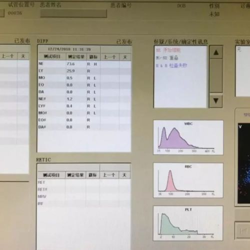 仅通过外周血形态就发现一例M3，她是怎么做到的？