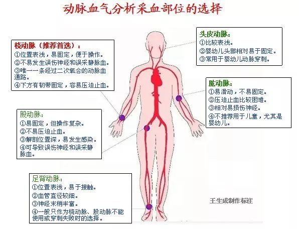 抽血气的部位示意图图片