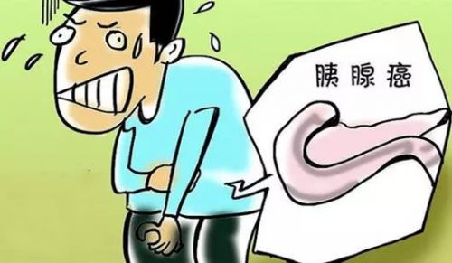 体检发现肿瘤标志物CA199升高，你慌不慌？