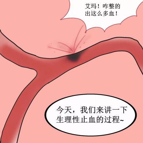 漫画教你记住凝血瀑布学说