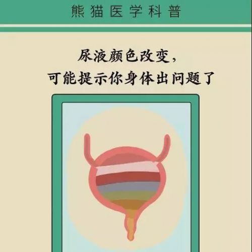 尿液颜色变化，提防以下情况