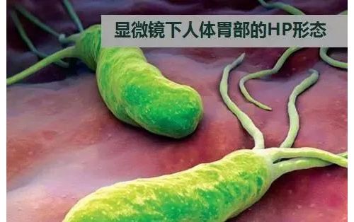 幽门螺杆菌检测的临床应用