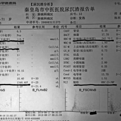 “消失”的尿潜血