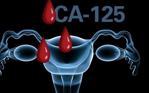 男性CA125一千多，什么情况？