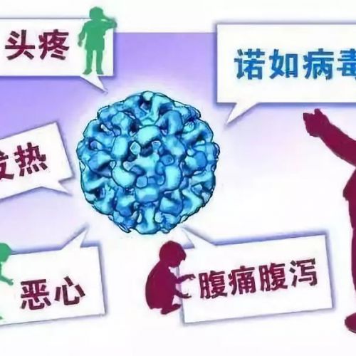 诺如病毒是什么？为什么能在浙江大学一天感染69人？
