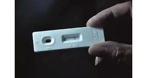 HIV感染实验室检测