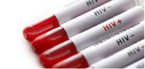 警惕！HIV窗口期的感染者传染性最强！