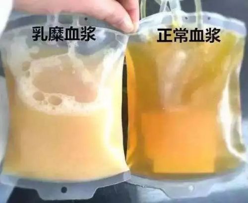 是谁让检验科医生闻风丧胆？